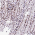 Anti-RRNAD1 Antibody