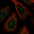 Immunofluorescent staining of human cell line U-2 OS shows localization to nucleoli.