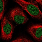 Immunofluorescent staining of human cell line U-2 OS shows localization to nucleoplasm.