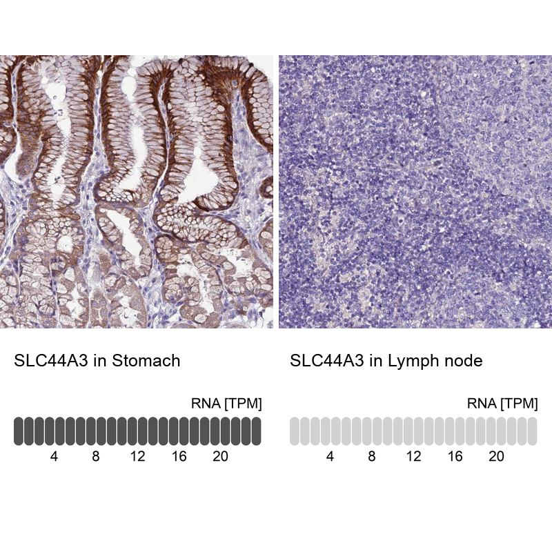 Anti-SLC44A3 Antibody