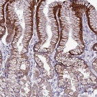 Immunohistochemical staining of human stomach shows high expression.