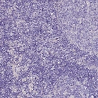 Immunohistochemical staining of human lymph node shows low expression as expected.