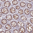 Anti-C10orf11 Antibody