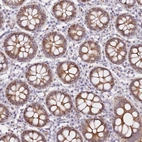 Anti-C10orf11 Antibody