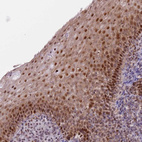 Immunohistochemical staining of human tonsil shows moderate nuclear and cytoplasmic positivity in squamous epithelial cells.