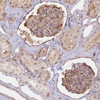 Immunohistochemical staining of human kidney shows moderate cytoplasmic and nuclear positivity in cells in glomeruli and tubules.