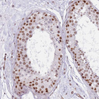 Immunohistochemical staining of human testis shows moderate nuclear positivity in cells in seminiferous ducts.