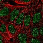 Immunofluorescent staining of human cell line RT4 shows localization to nucleoplasm.