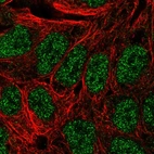 Immunofluorescent staining of human cell line RT4 shows localization to nucleoplasm.