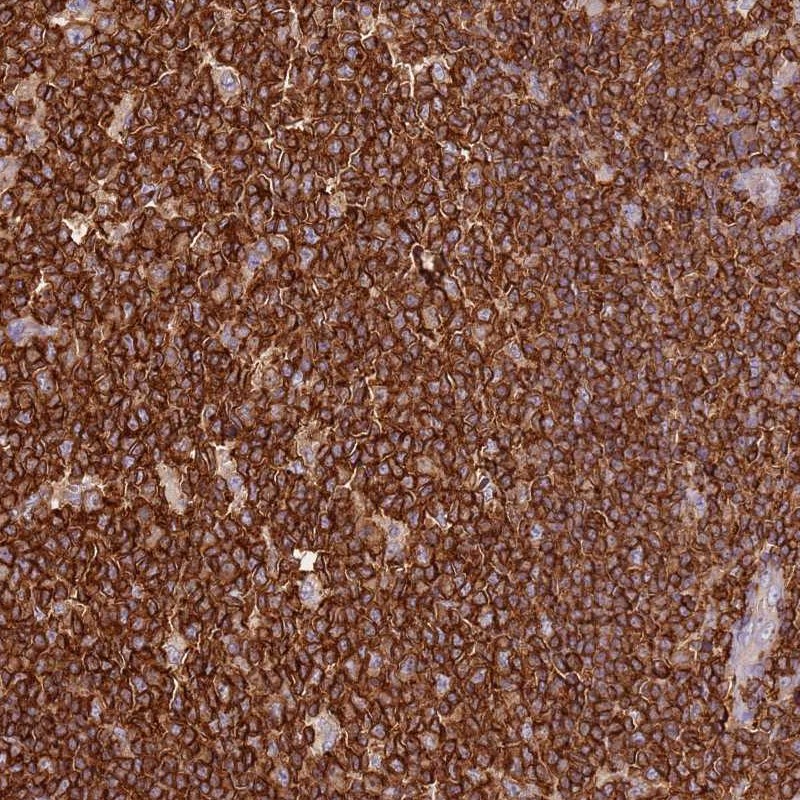 Anti-OR6P1 Antibody