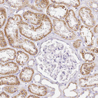 Anti-OR2B11 Antibody