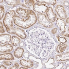Anti-OR2B11 Antibody