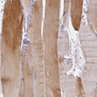 Immunohistochemical staining of human skeletal muscle shows strong cytoplasmic positivity in myocytes.