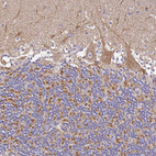 Immunohistochemical staining of human cerebellum shows weak granular cytoplasmic positivity in Purkinje cells.