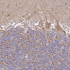 Immunohistochemical staining of human cerebellum shows weak granular cytoplasmic positivity in Purkinje cells.