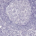 Immunohistochemical staining of human lymph node shows no positivity in non germinal center cells as expected.