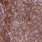 Anti-C20orf27 Antibody