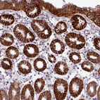 Immunohistochemical staining of human stomach shows strong cytoplasmic positivity in glandular cells.