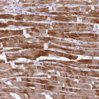 Immunohistochemical staining of human heart muscle shows strong cytoplasmic positivity in cardiomyocytes.