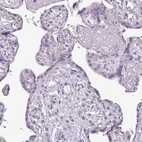 Immunohistochemical staining of human placenta shows no positivity in trophoblastic cells as expected.