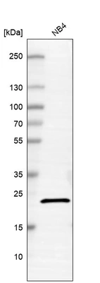 Western blot analysis in human cell line NB4.