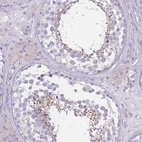 Anti-PDHA2 Antibody