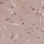 Anti-SH3BGRL2 Antibody