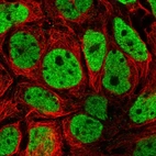 Immunofluorescent staining of human cell line CACO-2 shows localization to nucleoplasm.