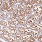 Anti-TPD52L2 Antibody