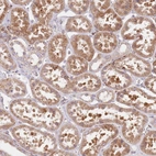 Anti-TPD52L2 Antibody