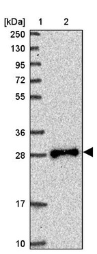 Anti-TPD52L2 Antibody