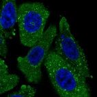 Immunofluorescent staining of human cell line PC-3 shows localization to cytosol & vesicles.