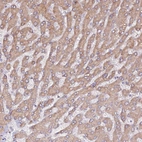 Anti-HSD17B7 Antibody