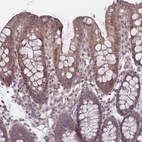 Immunohistochemical staining of human colon shows moderate cytoplasmic positivity in glandular cells.