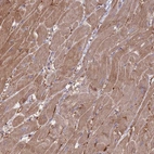 Immunohistochemical staining of human heart shows moderate cytoplasmic positivity in cardiomyocytes.