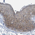 Immunohistochemical staining of human skin using Anti-RPL32 antibody HPA047501.