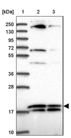 Lane 1: Marker [kDa] 250, 130, 95, 72, 55, 36, 28, 17, 10_br/_Lane 2: Human cell line RT-4_br/_Lane 3: Human cell line U-251MG sp