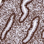 Immunohistochemical staining of human endometrium shows strong nuclear positivity in glandular cells.
