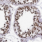 Immunohistochemical staining of human testis shows strong nuclear positivity in cells in seminiferous ducts.