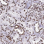 Immunohistochemical staining of human kidney shows strong nuclear positivity in cells in tubules.