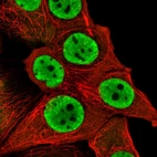 Immunofluorescent staining of human cell line MCF7 shows localization to nucleoplasm.