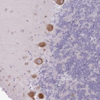 Anti-OR5L2 Antibody