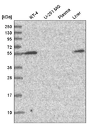 Anti-CHST3 Antibody