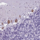 Anti-OR6B2 Antibody