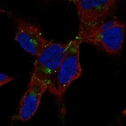 Anti-GJA1 Antibody
