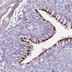 Anti-IFNA6 Antibody