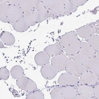 Immunohistochemical staining of human skeletal muscle shows low expression as expected.