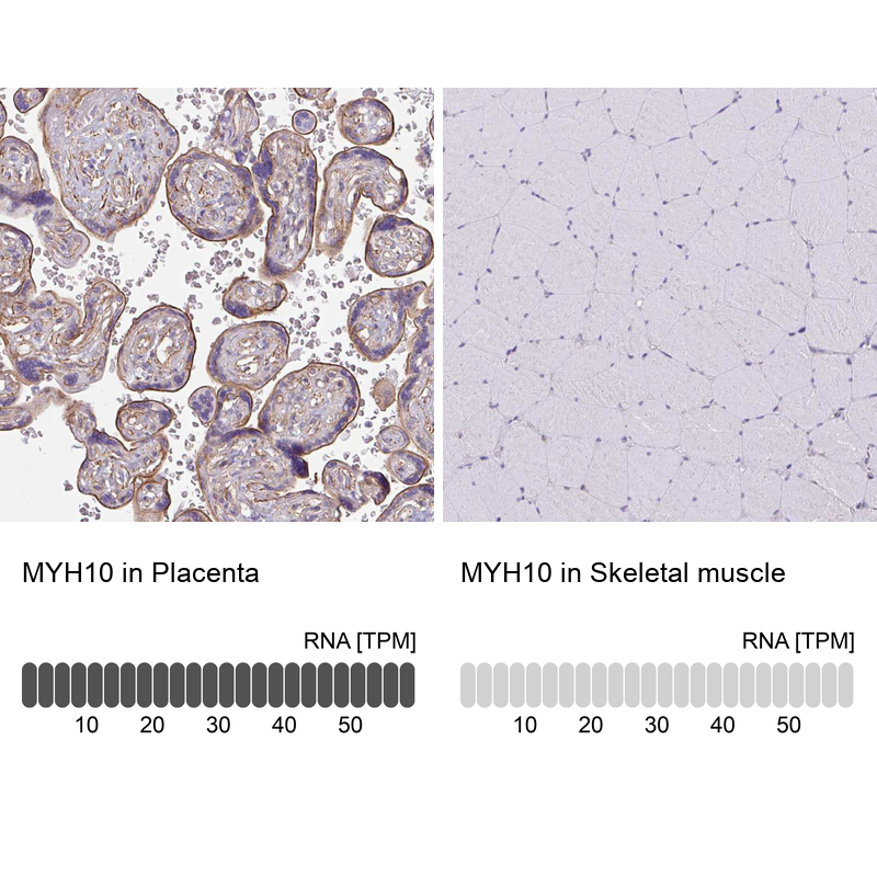 Anti-MYH10 Antibody