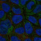 Immunofluorescent staining of human cell line RT4 shows localization to cytosol & vesicles.