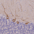 Immunohistochemical staining of human cerebellum shows weak to moderate cytoplasmic positivity in Purkinje cells.